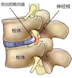 江门台山市群众病院痛苦悲伤科招人了-1.jpg