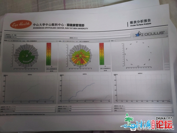 中山眼科看的纯真疱疹病毒角膜炎